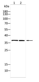 LDHB Antibody