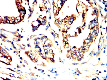 YBX1 Antibody