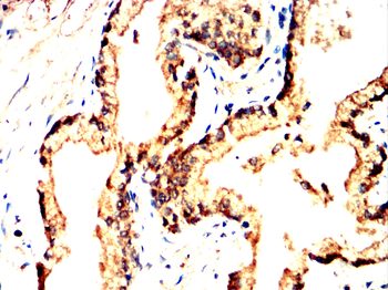 HSPH1 Antibody