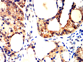 HSPH1 Antibody