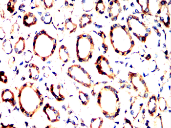 CALD1 Antibody