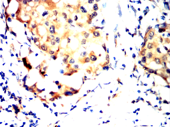 ATP2A2 Antibody