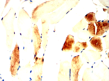 ATP2A2 Antibody