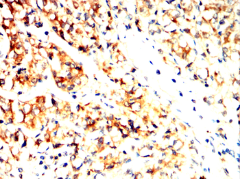 KIF23 Antibody
