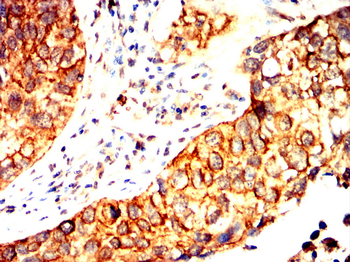 PFKM Antibody