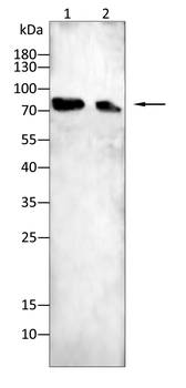 PFKM Antibody
