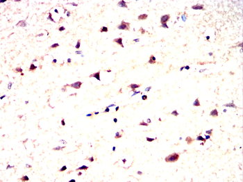 PTPN11 Antibody
