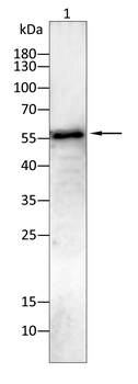 KRT14 Antibody