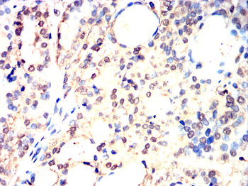 TP53BP1 Antibody