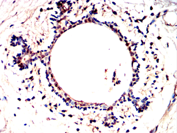 TP53BP1 Antibody