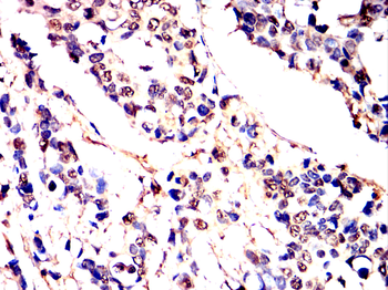 HNRNPK Antibody