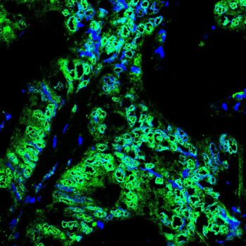 HNRNPK Antibody