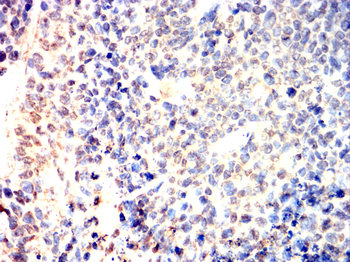 HNRNPK Antibody