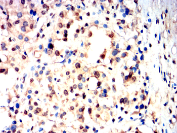 HNRNPK Antibody