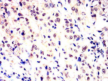 EIF2AK2 Antibody
