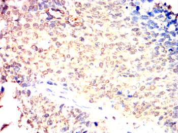 EIF2AK2 Antibody