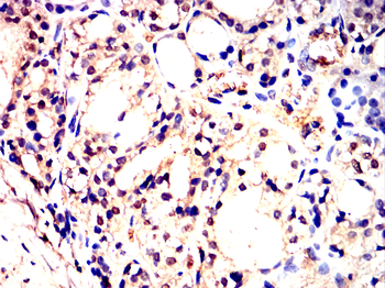 EIF2AK2 Antibody