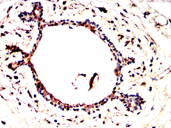 HTT Antibody