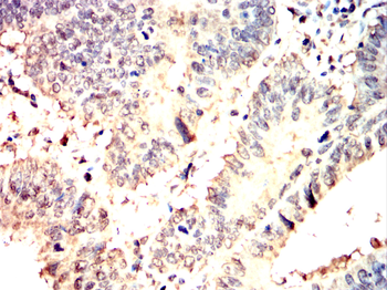 HTT Antibody