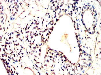 HTT Antibody