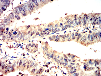 EZH2 Antibody