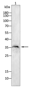 PPT1 Antibody