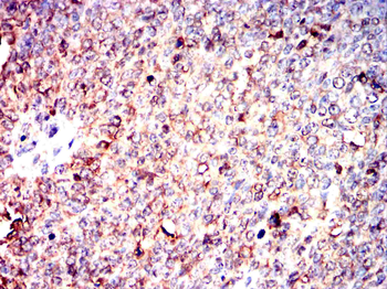 GARS1 Antibody