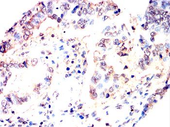 CLIC4 Antibody