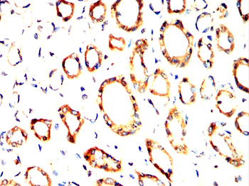 CNN1 Antibody