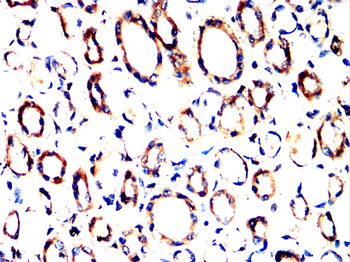 SCARB1 Antibody