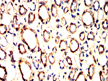STAT5A Antibody