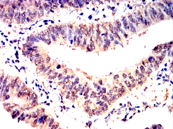 NFKB1 Antibody