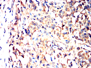 ADAMTS13 Antibody