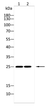 GCLM Antibody