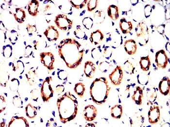 GCLM Antibody