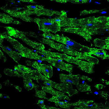 GCLM Antibody