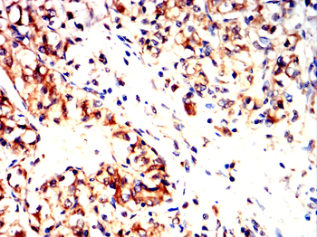 GCLM Antibody