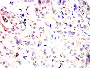 USP11 Antibody
