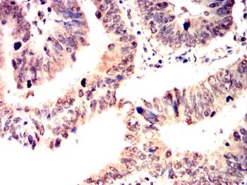 USP11 Antibody