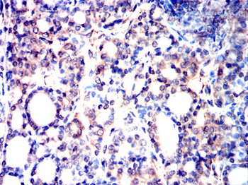 USP11 Antibody