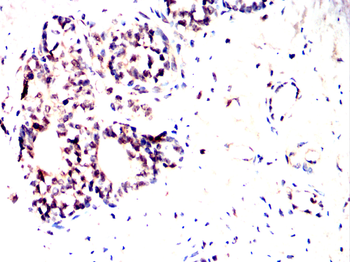 MKRN2 Antibody