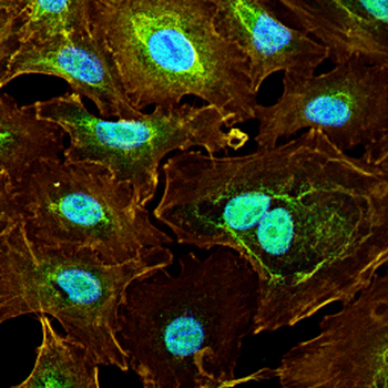 RNF20 Antibody