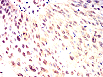 RNF20 Antibody