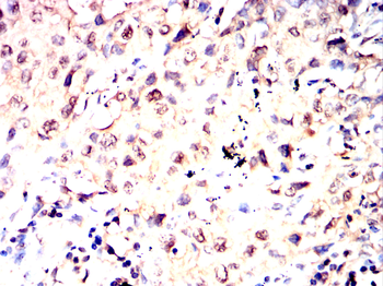 PSMC2 Antibody
