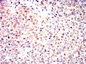 PSMC2 Antibody