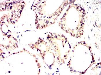 RAD23B Antibody