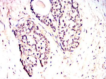 MAPK9 Antibody