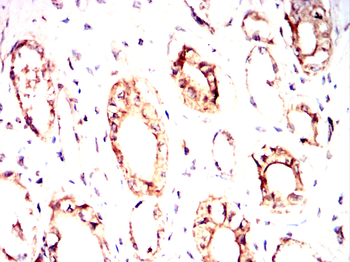 DSG2 Antibody