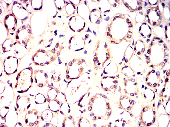VRK1 Antibody