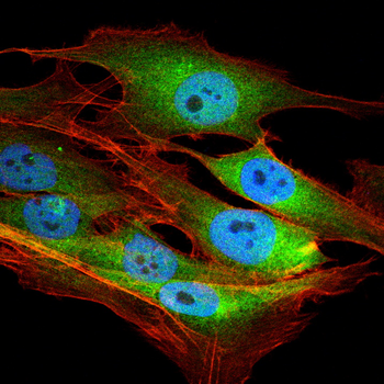 RPS6KB2 Antibody